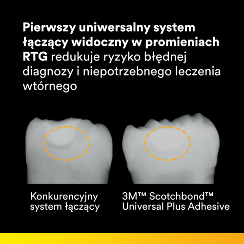 Scotchbond Universal Plus Zestaw 3+1